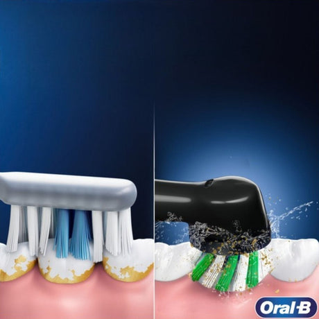 Oral-B Vitality Pro Electric Toothbrush + Brush Head - Purple